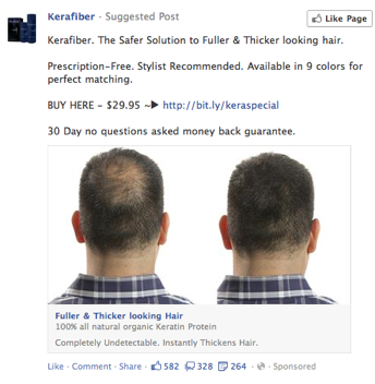 A Facebook ad for hair loss products